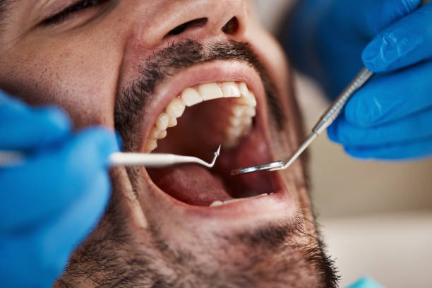 Best Emergency Treatment for Jaw Pain or Injury in Castle Rock, WA